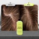 Limba Cosmetics Detox Oily Hair Cleansing Shampoo, 300 ml